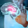Neurologia